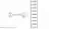 Fig. 13 - Advanced dynamic channel assignment