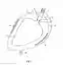 Fig. 02 - Organ perfusion system and device