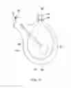 Fig. 10 - Organ perfusion system and device