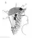 Fig. 01 - HALF HEAD WIG