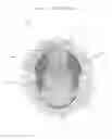 Fig. 02 - HALF HEAD WIG