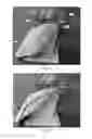 Fig. 02 - DRAPE ATTACHMENT FOR A STANDARD CAP