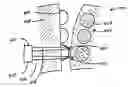 Fig. 01 - Apparatus for coupling and decoupling button and loop connections of a garment