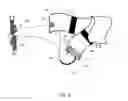 Fig. 07 - Strap for securing a zipper slider