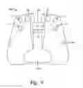 Fig. 06 - Pressure reducing device