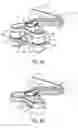 Fig. 07 - Device for frothing a liquid