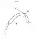 Fig. 04 - TROCAR, PORT, AND SURGERY ASSISTANCE SYSTEM