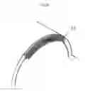 Fig. 05 - TROCAR, PORT, AND SURGERY ASSISTANCE SYSTEM