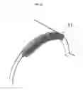 Fig. 08 - TROCAR, PORT, AND SURGERY ASSISTANCE SYSTEM