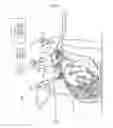 Fig. 14 - TROCAR, PORT, AND SURGERY ASSISTANCE SYSTEM