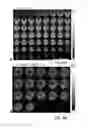 Fig. 07 - Functional Magnetic Resonance Imaging (fMRI) Methodology Using Transverse Relaxation Preparation and Non-Echo-Planar Imaging (EPI) Pulse Sequences