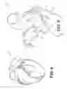 Fig. 05 - Method and system for image processing to determine patient-specific blood flow characteristics