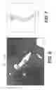 Fig. 06 - Method and system for image processing to determine patient-specific blood flow characteristics