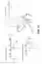 Fig. 10 - Method and system for image processing to determine patient-specific blood flow characteristics