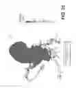 Fig. 15 - Method and system for image processing to determine patient-specific blood flow characteristics