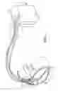 Fig. 02 - Atrial arrhythmia detection during intermittent instances of ventricular pacing in a cardiac medical device