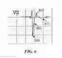 Fig. 07 - Systems and methods for assessing electrocardiogram reliability