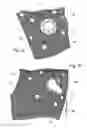 Fig. 04 - Device for applying electrode assemblies