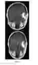 Fig. 07 - METHODS AND SYSTEMS FOR PROCESSING MRI IMAGES TO DETECT CANCER