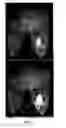Fig. 09 - METHODS AND SYSTEMS FOR PROCESSING MRI IMAGES TO DETECT CANCER