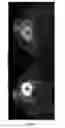 Fig. 10 - METHODS AND SYSTEMS FOR PROCESSING MRI IMAGES TO DETECT CANCER