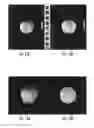 Fig. 15 - Systems, methods, compositions and devices for in vivo magnetic resonance imaging of lungs using perfluorinated gas mixtures