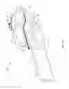 Fig. 16 - Fluid diversion mechanism for bodily-fluid sampling