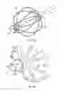 Fig. 05 - Basket catheter with microelectrode array distal tip