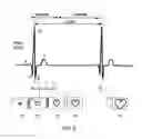 Fig. 04 - Method, apparatuses, and systems useful in conducting image guided interventions