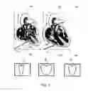 Fig. 08 - Method, apparatuses, and systems useful in conducting image guided interventions