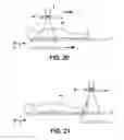 Fig. 13 - Radiographic apparatus and method of using the same