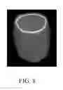 Fig. 10 - Dynamic bowtie filter for cone-beam/multi-slice CT