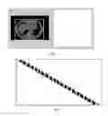 Fig. 03 - Computed tomography data-based cycle estimation and four-dimensional reconstruction