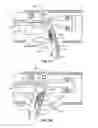 Fig. 07 - ABLATION DEVICE WITH ARTICULATED IMAGING TRANSDUCER