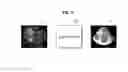 Fig. 06 - Ultrasound imaging apparatus and method of controlling the same
