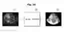Fig. 13 - Ultrasound imaging apparatus and method of controlling the same