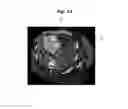 Fig. 15 - Ultrasound imaging apparatus and method of controlling the same