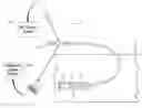 Fig. 01 - DEVICE FOR ABLATING ARTERIAL PLAQUE