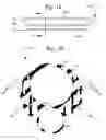 Fig. 14 - DEVICE FOR ABLATING ARTERIAL PLAQUE