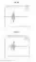 Fig. 07 - Phantom for measuring thickness of thin layer using ultrasonic imaging device and method of using thereof