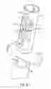 Fig. 09 - Biceps tenodesis delivery tools