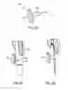 Fig. 10 - Biceps tenodesis delivery tools