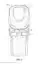 Fig. 04 - IMPLANT WITH SUTURE ANCHOR FIXATION CAPABILITY