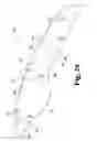 Fig. 23 - Surgical device