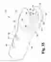 Fig. 33 - Surgical device