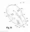Fig. 48 - Surgical device