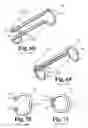 Fig. 63 - Surgical device