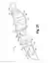 Fig. 24 - Surgical device