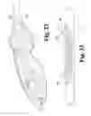 Fig. 31 - Surgical device