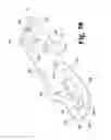 Fig. 36 - Surgical device